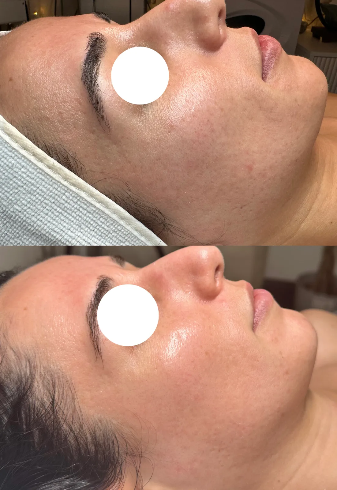 Regenerative Skin Therapies case study, before and after at SORA Skin & Ritual House