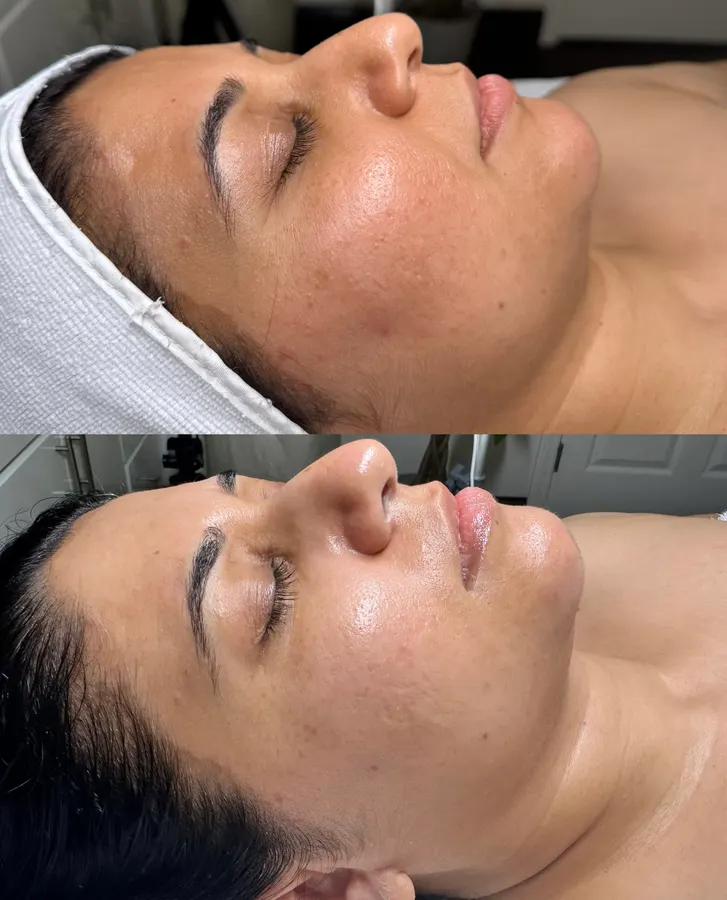 Smoother texture, luminous finish, real before and after at SORA Skin & Ritual House in Peoria, AZ