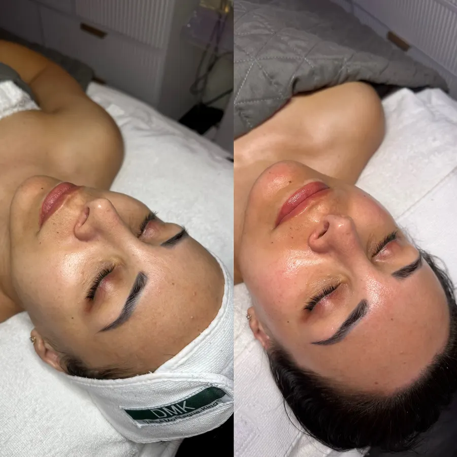 Hydrated, luminous glow, real before and after at SORA Skin & Ritual House in Peoria, AZ