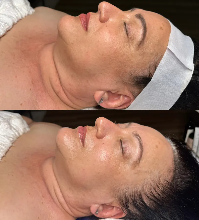 Lifted, more radiant skin, real before and after at SORA Skin & Ritual House in Peoria, AZ