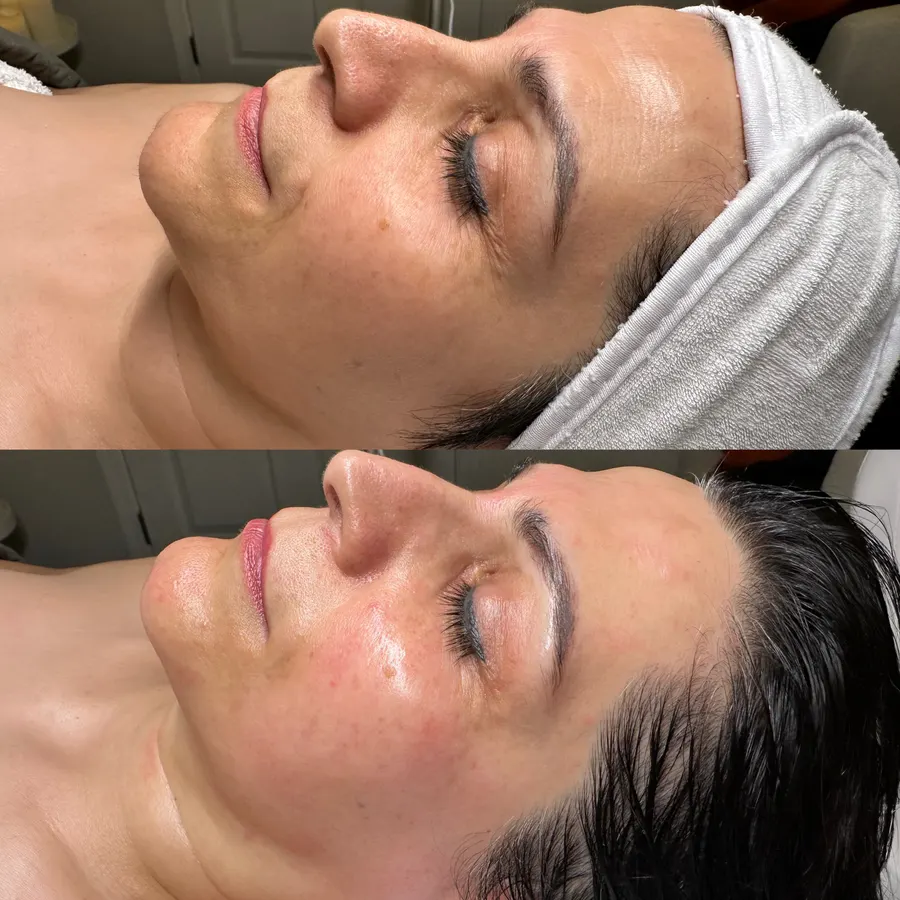 Softer lines, fresh radiance, real before and after at SORA Skin & Ritual House in Peoria, AZ