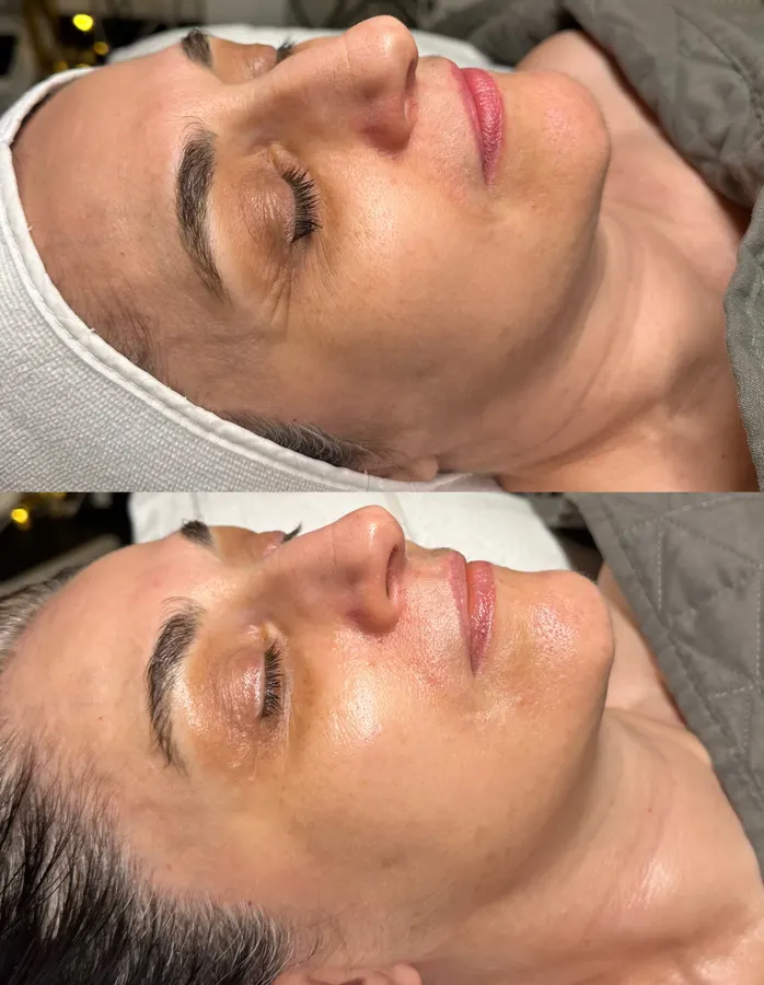 Softer lines, hydrated glow, real before and after at SORA Skin & Ritual House in Peoria, AZ