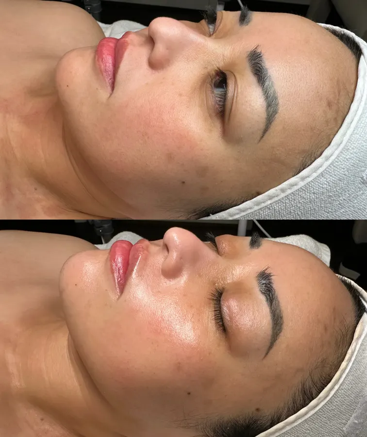 Firmer, luminous skin, real before and after at SORA Skin & Ritual House in Peoria, AZ